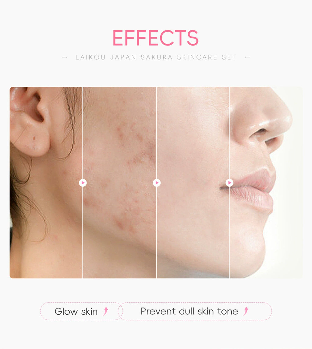 New Arrival Laikou Cherry Blossom 8-Piece Set Birthday Gift Facial Skin Care Gift Set Laikou Hydrating Moisturizing Genuine Article