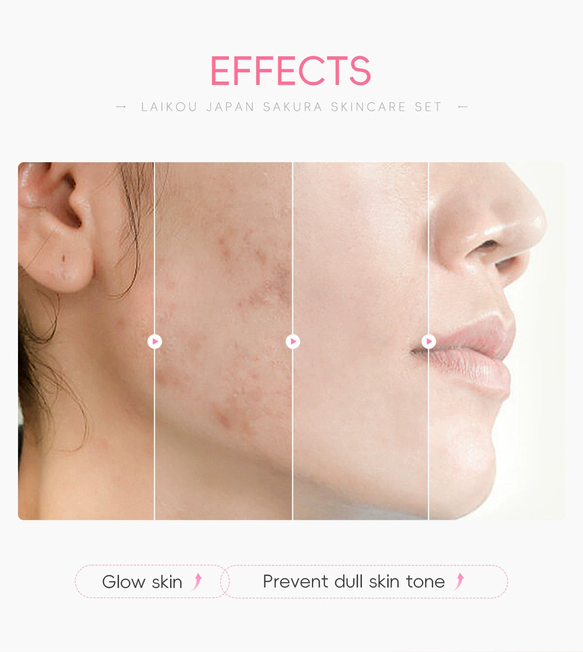 New Arrival Laikou Cherry Blossom 8-Piece Set Birthday Gift Facial Skin Care Gift Set Laikou Hydrating Moisturizing Genuine Article