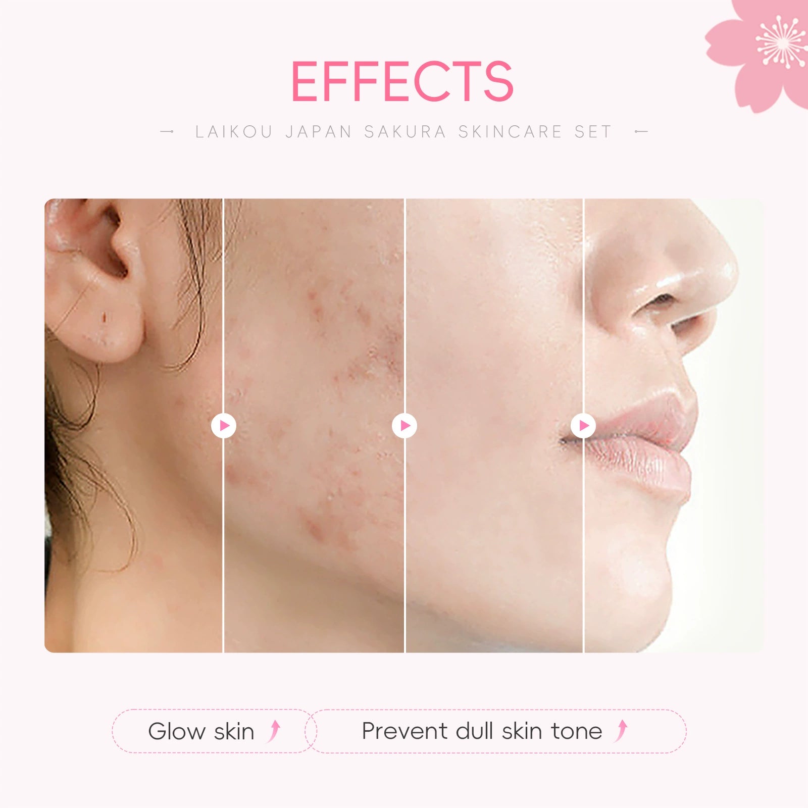 New Arrival Laikou Cherry Blossom 8-Piece Set Birthday Gift Facial Skin Care Gift Set Laikou Hydrating Moisturizing Genuine Article